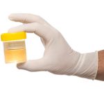 DUI Chemical Tests Urine Test